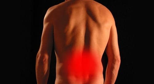 Quels sont les types de douleurs dorsales ?
